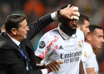 تقارير توضح فرص لحاق روديجر بالكلاسيكو بعد إصابته الدموية مع ريال مدريد