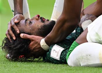 محمد العويس يطمئن الجماهير السعودية بشأن إصابة الشهراني أمام الأرجنتين