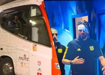 تحطم حافلة ليون في مارسيليا وإصابة قوية لـ جروسو ومساعده