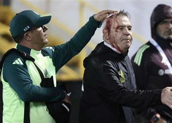 خاص تفاصيل إصابة خافيير أجيري المرعبة في مباراة المكسيك وهندوراس