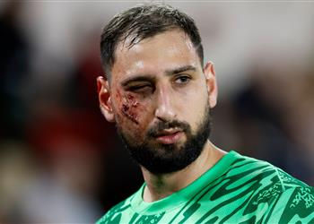 أول تعليق من مدافع موناكو بعد تسببه في إصابة دوناروما المرعبة