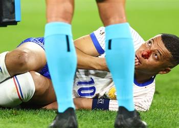 أول تعليق من مبابي بعد إصابته الخطيرة مع فرنسا في يورو 2024
