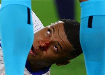 الاتحاد الفرنسي يصدر بيان ا رسمي ا بشأن حالة مبابي