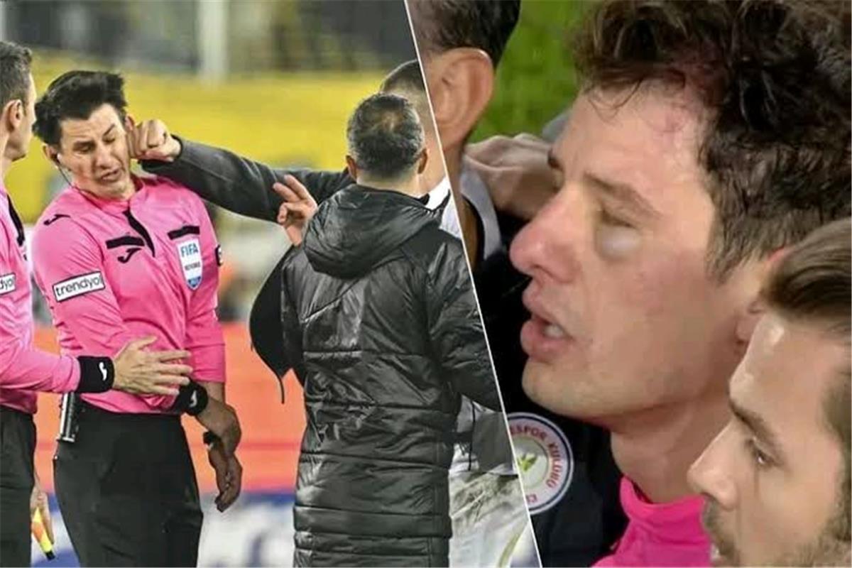  الحكم التركي خليل أوموت