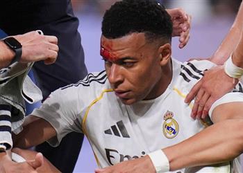 إجراء احترازي لحماية مبابي في مباراة ريال مدريد وبايرن ميونخ