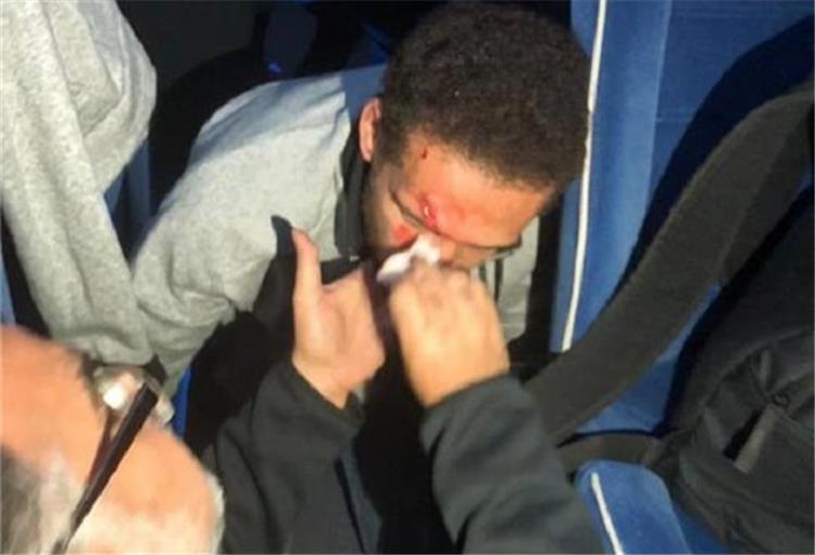 اصابة هشام محمد قبل مباراة نهائي دوري ابطال افريقيا بين الترجي والاهلى