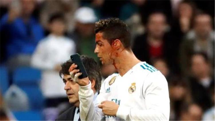 بالفيديو طلب غريب من رونالدو لطبيب ريال مدريد عقب إصابته ضد الديبور