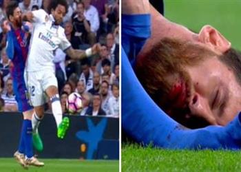 تحكيم_الكلاسيكو 2 بالفيديو ماركا المدريدية تتفق مع سبورت و موندو ديبورتيفو الكتالونيتين الحكم تغاضى عن طرد مارسيلو بعد إيذاء ميسي