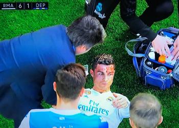 فيديو إصابة قوية لرونالدو في مباراة ريال مدريد وديبورتيفو لاكورونيا