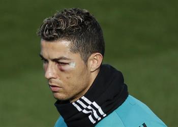 الكشف عن موقف رونالدو من مواجهة ليجانيس بالكأس