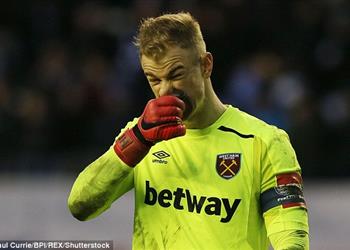 جو هارت يفكر في إنهاء إعارته إلى وست هام بسبب مونديال روسيا