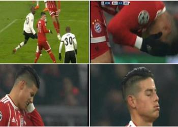 مولر يتسبب بإصابة قوية لخاميس رودريجيز تثير مخاوف بايرن ميونخ