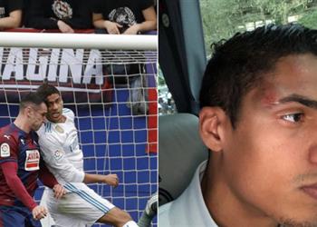 فاران يكشف سبب تغييره أمام إيبار