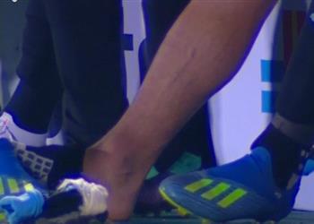 فيديو الإصابة تجبر سواريز على مغادرة مباراة أوزبكستان