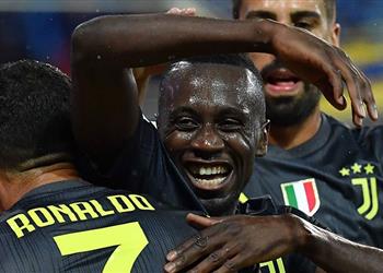 ماتويدي لاعبو يوفنتوس قادرين على مساعدة رونالدو للتسجيل