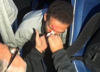 بعد هجوم جماهير الترجي على حافلة الأهلي 8 غرز في وجه هشام محمد