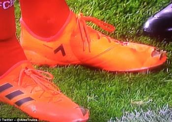 هوملز يوضح سبب لعبه بحذاء مقطوع