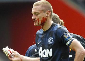 حارس مانشستر يونايتد السابق فيديتش كان مروع ا ومخيف ا