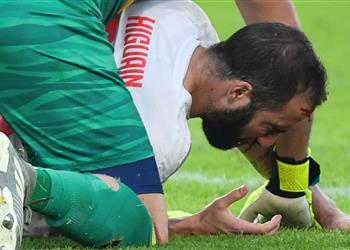 إصابة هيجواين في تدريبات يوفنتوس قبل مواجهة ميلان