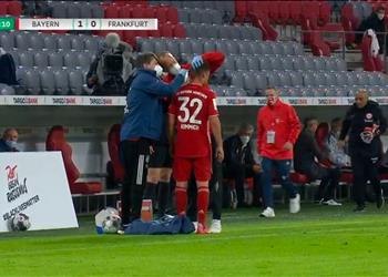 إصابة دموية لـ كيميتش في مباراة بايرن ميونخ وفرانفكورت بكأس ألمانيا