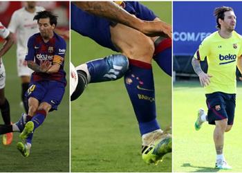 صورة ماركا تكشف كيف تأثرت قدم ميسي من التدخل العنيف لدييجو كارلوس