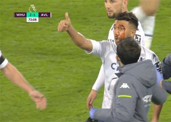 فيديو إصابة دموية لـ تريزيجيه في مباراة أستون فيلا ووست هام