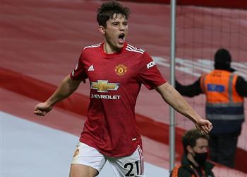 جيمس بعد سداسية مانشستر يونايتد أمام ليدز فعلنا ما تدربنا عليه