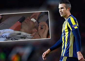 لعنة الإصابات صور فان بيرسي كاد يفقد بصره في مباراة فريقه بالدوري التركي