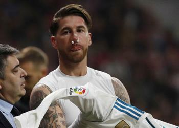 الكشف عن تفاصيل إصابة راموس