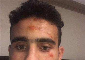 باسم مرسي يطمئن الجماهير بعد حادث السير