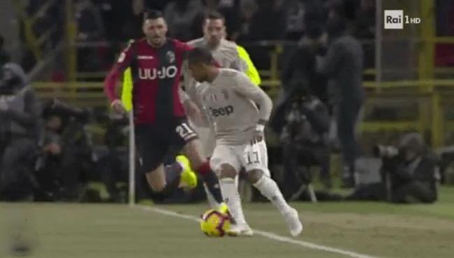 كوبري دوجلاس كوستا الممتع فى مباراة يوفنتوس وبولونيا