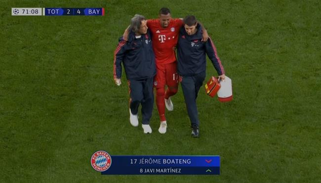 خروج بواتينج مصابا في مباراة بايرن ميونخ وتوتنهام بدوري ابطال اوروبا