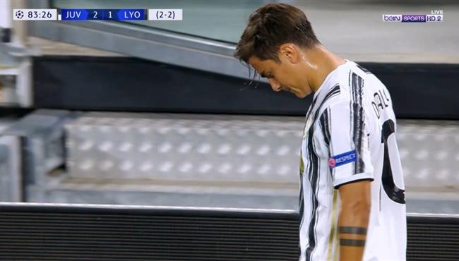 اصابه ديبالا وخروجه فى مباراة يوفنتوس وليون