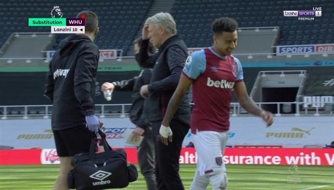 اصابة لينجارد في مباراة وست هام ونيوكاسل بالدوري الانجليزي