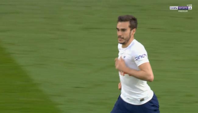 هدف هاري وينكس العالمي في مرمي موريكامب بكاس الاتحاد الانجليزي